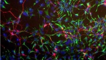 Биологи нашли гормон, превращающий стволовые клетки в нейроны